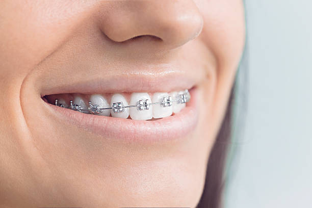 Best Invisalign and Clear Aligners  in River Road, WA